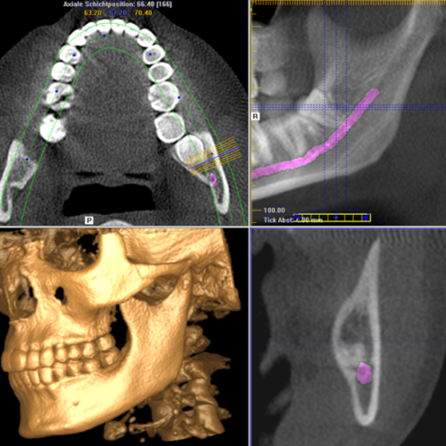 Dentomaxillofaciale Radiologie