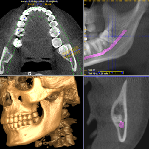 Maxillofacial Imaging