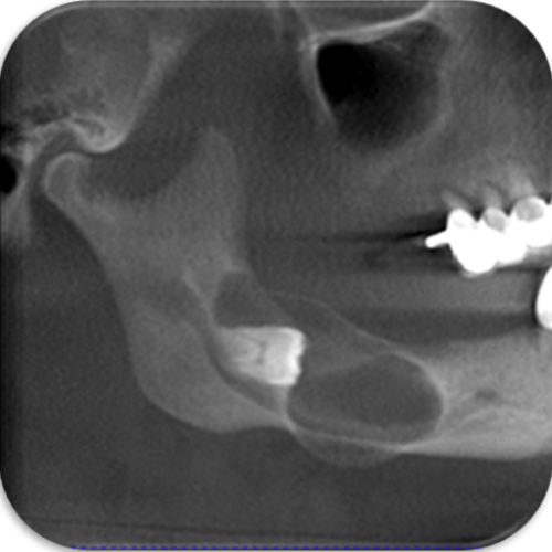 Orale Pathologie  - Oralchirurgie